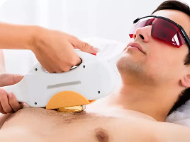 Front Laser Hair Removal